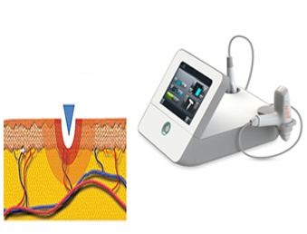 Hitt for “Microneedle Ablative Fractional RF”