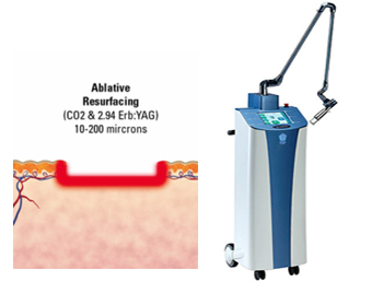 “Microneedle Ablative Fractional RF”