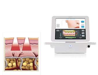 Hitt for “Microneedle Ablative Fractional RF”